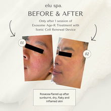 Load image into Gallery viewer, Exosome Age-R Renewal - 75min