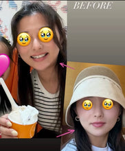 Load image into Gallery viewer, 11.11 50% OFF - Silvia LuxRF™ V-FaceLift and Tightening - 60min